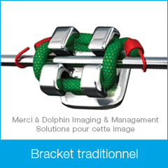 FR-DamonClear_BracketImages-traditional